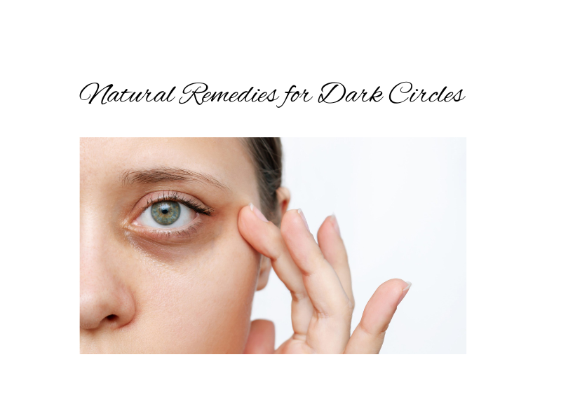 Natural Remedies for Dark Circles
