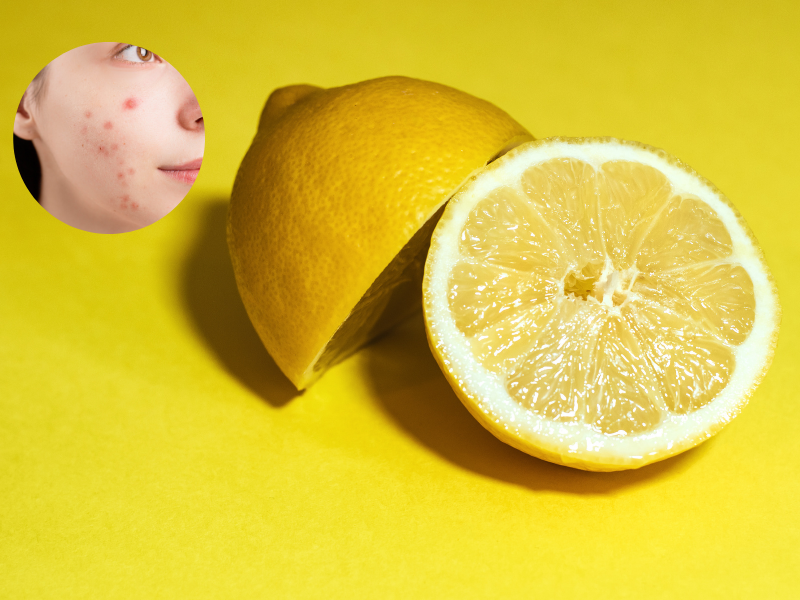 Benefits of Lemon Water for Oily Skin