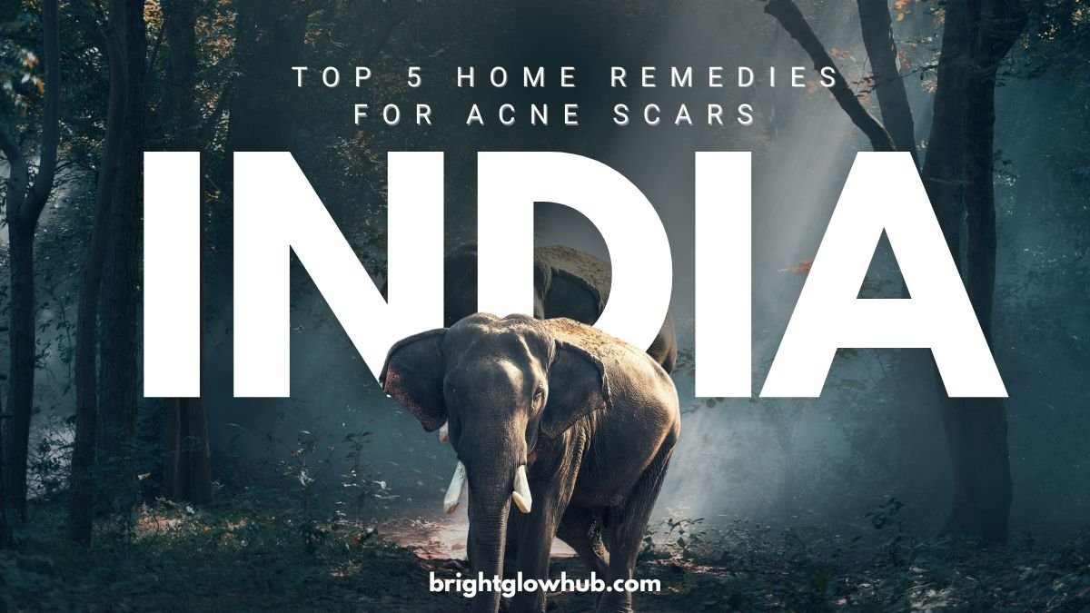 top 5 home remedies for acne scars