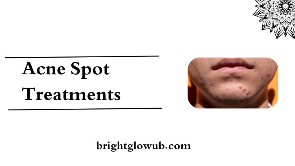 Best Acne Spot Treatments Available in the US
