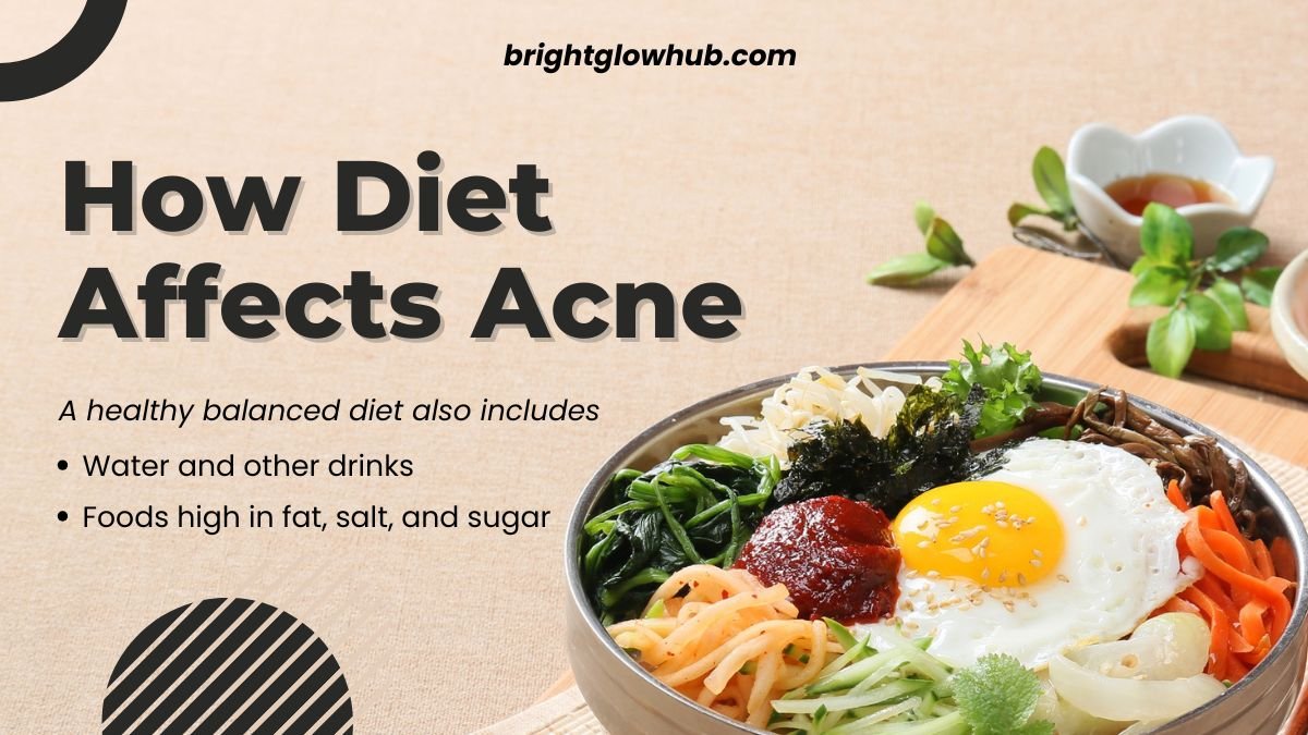 How Diet Affects Acne