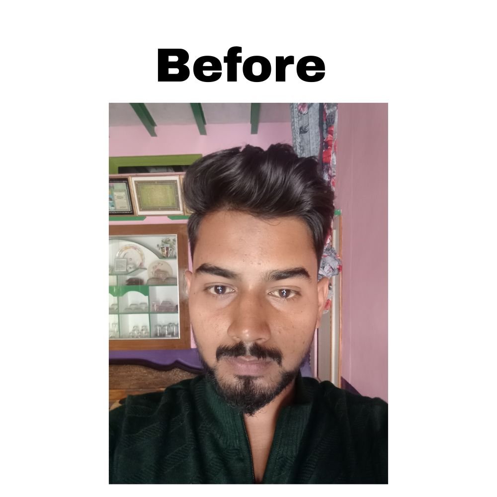 How to Remove Blackheads