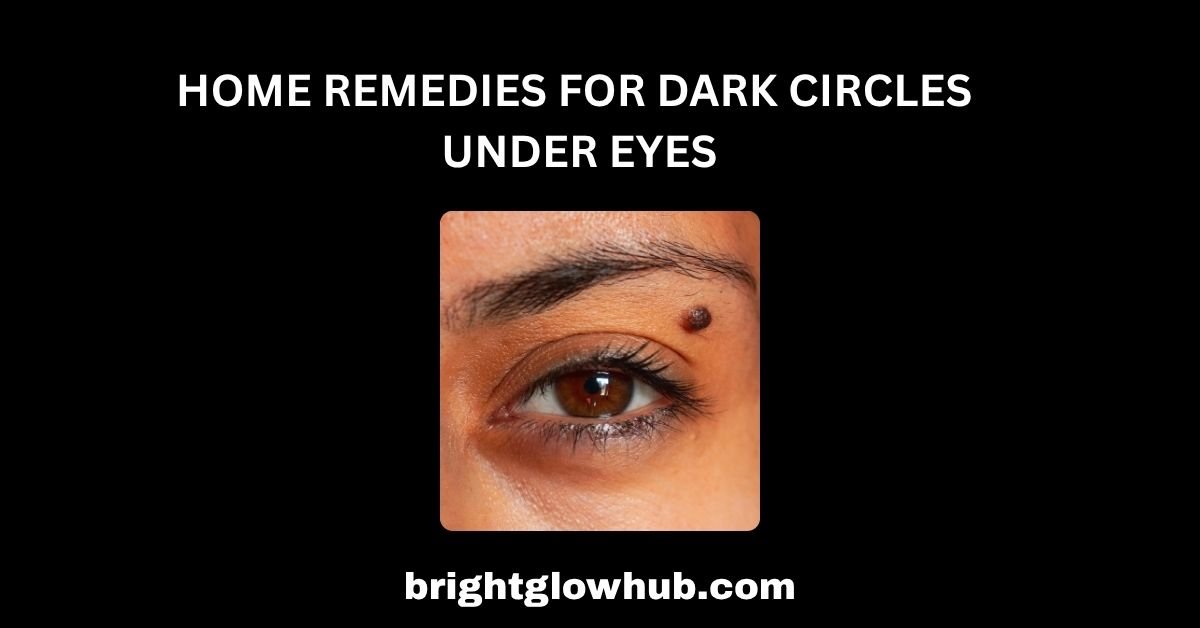 home remedies for dark circles under eyes
