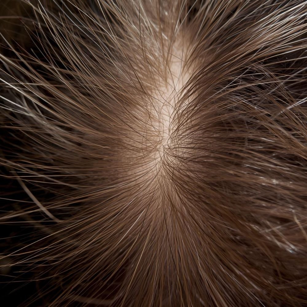 Coconut Oil for Hair