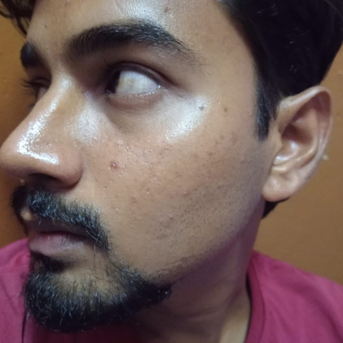 skarfix-plus brightening face serum