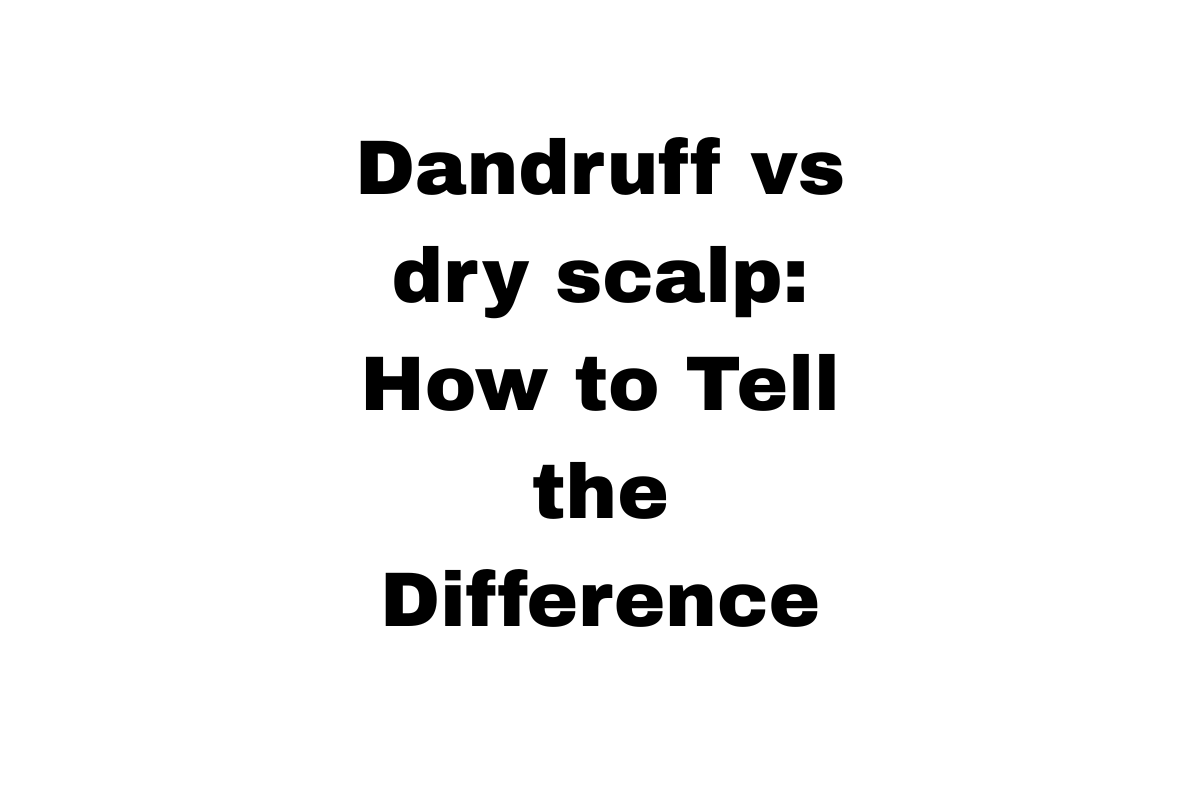 Dandruff vs dry scalp