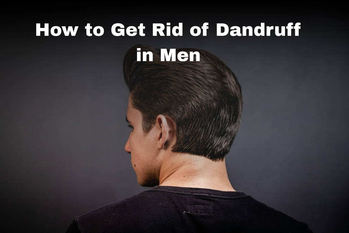 How to Get Rid of Dandruff in Men