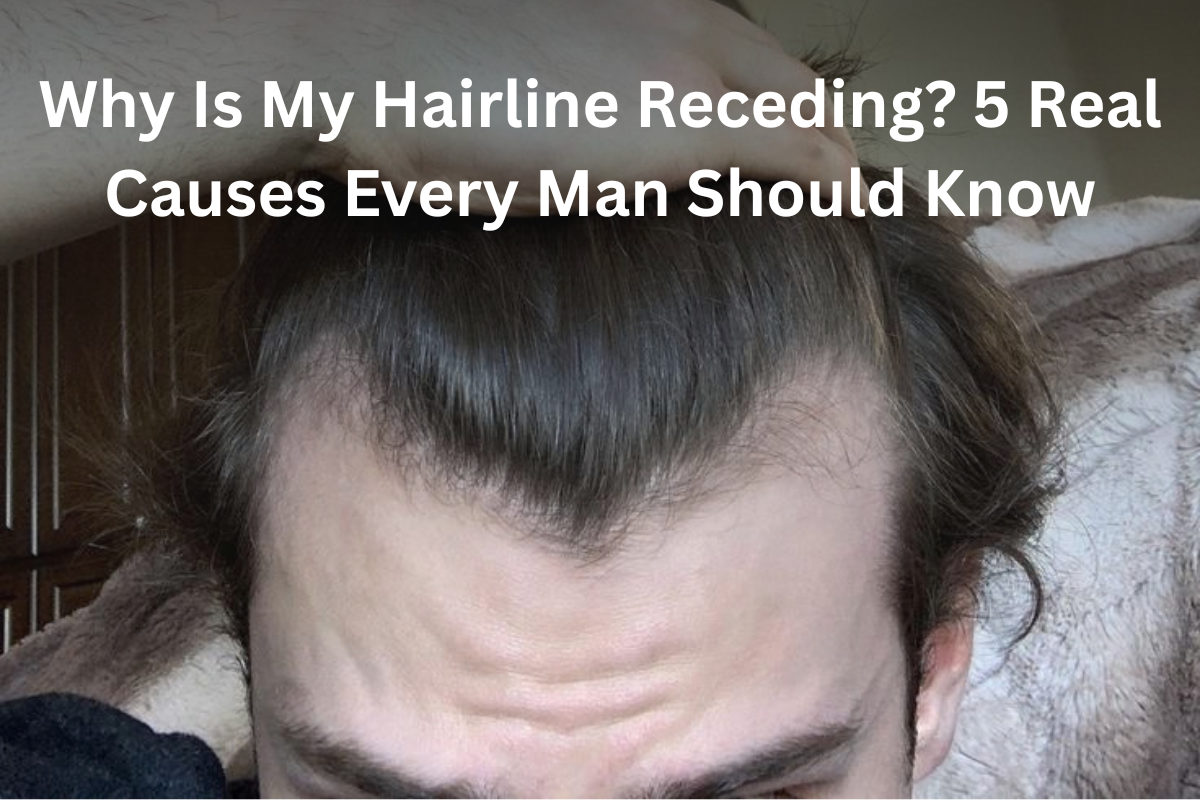 Why Is My Hairline Receding