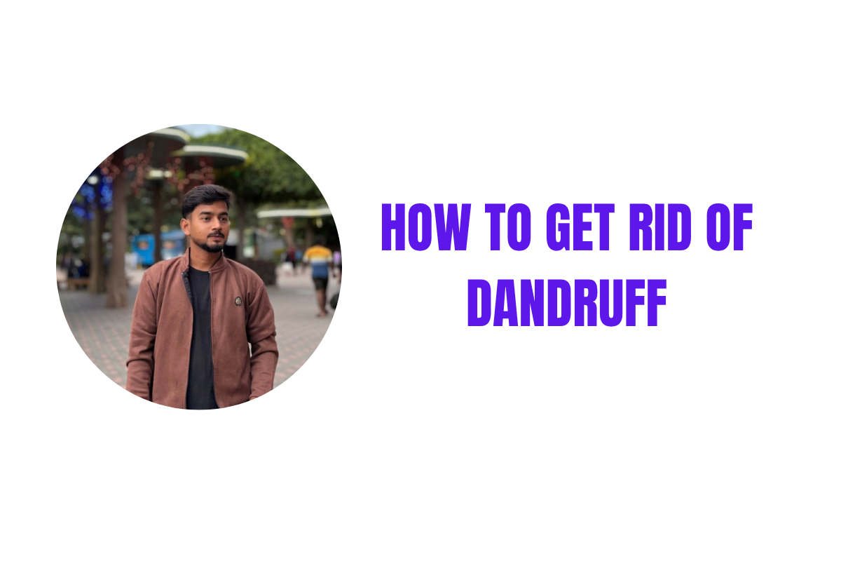 Dandruff & Scalp Problems